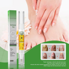 South Moon Nail Fungus Repair Pen Remove Onychomycosis Paronychia Reduce Toe Infection Brighten Nail Hand Foot Nail Care Liquid