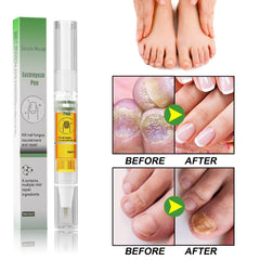 South Moon Nail Fungus Repair Pen Remove Onychomycosis Paronychia Reduce Toe Infection Brighten Nail Hand Foot Nail Care Liquid