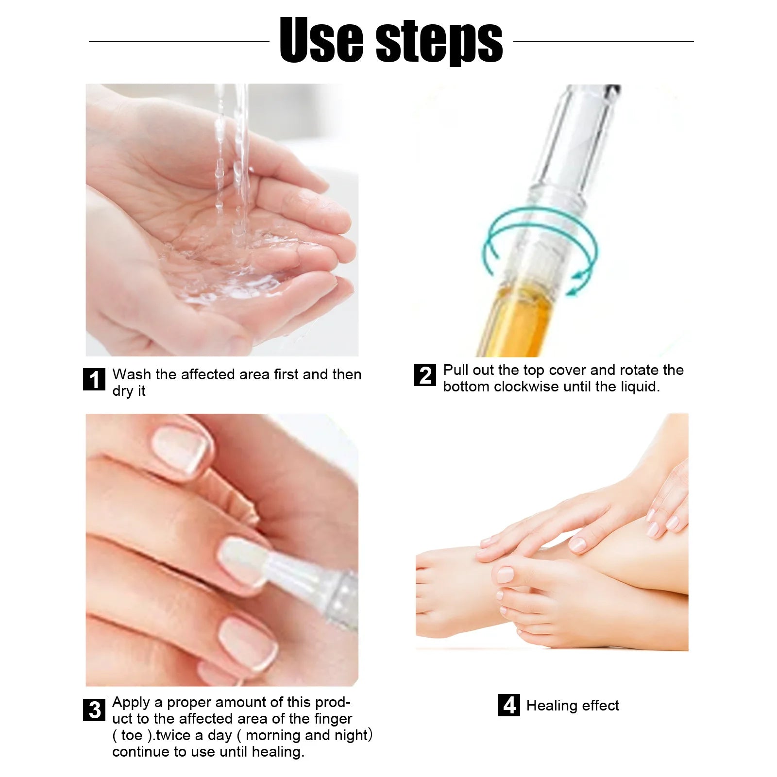 South Moon Nail Fungus Repair Pen Remove Onychomycosis Paronychia Reduce Toe Infection Brighten Nail Hand Foot Nail Care Liquid